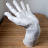 Plaster hand