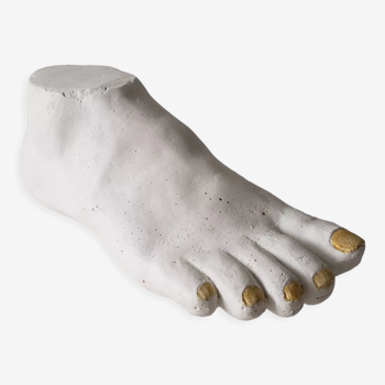 Woman's foot in plaster