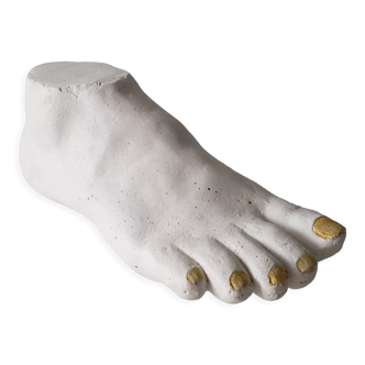 Woman's foot in plaster