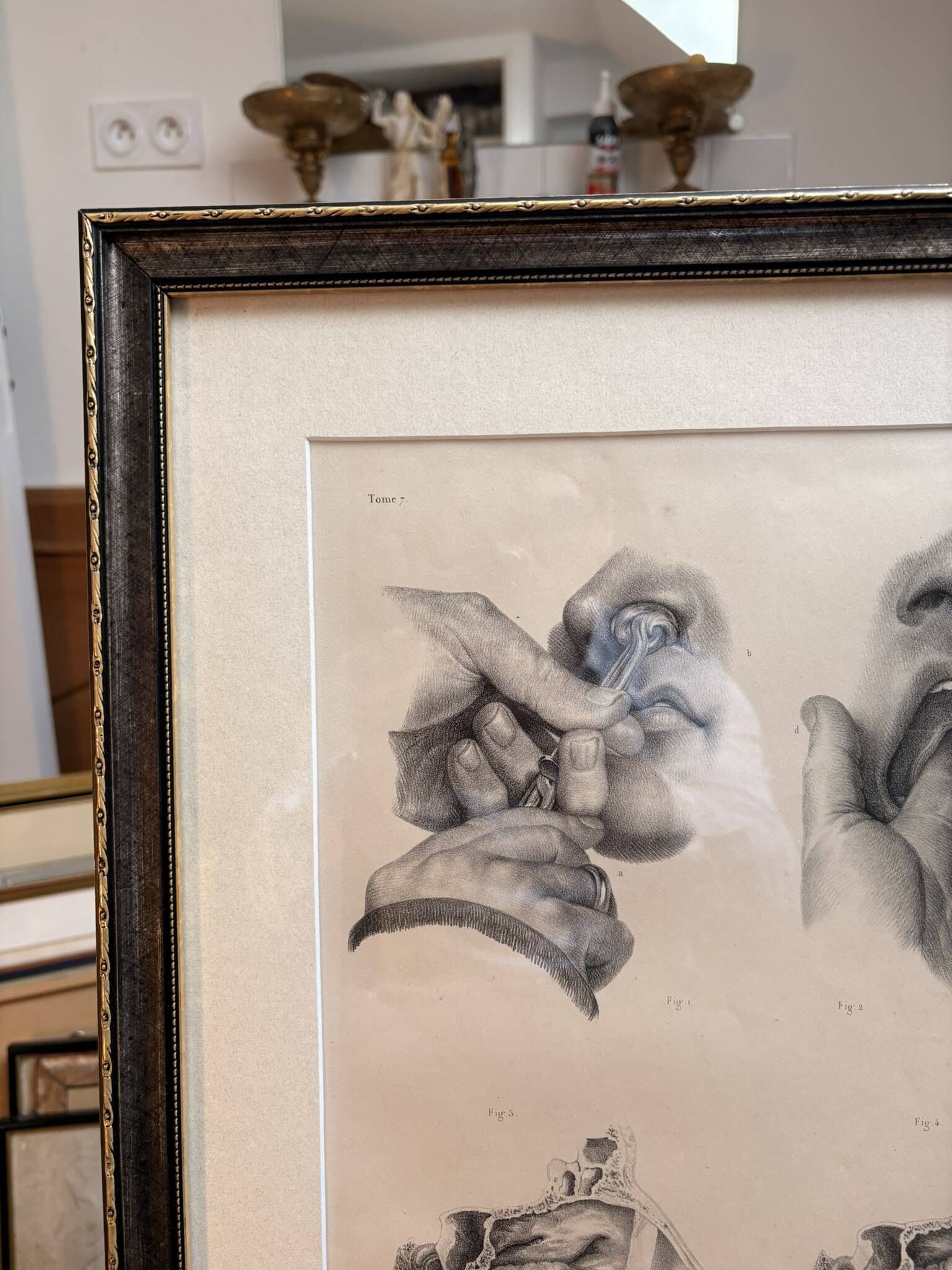Old Engraving Nose Nasal Cavity NICOLAS HENRI Jacob Bourgery Medical Anatomy