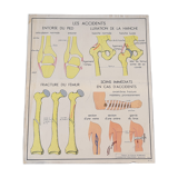 Rossignol educational posters