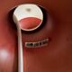 Vintage Louis Poulsen PH5 - Poul Henningsen - Danish design lamp