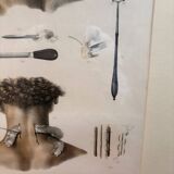 Print Engraving Material Surgery Seton Treatise Anatomy Man BOURGERY