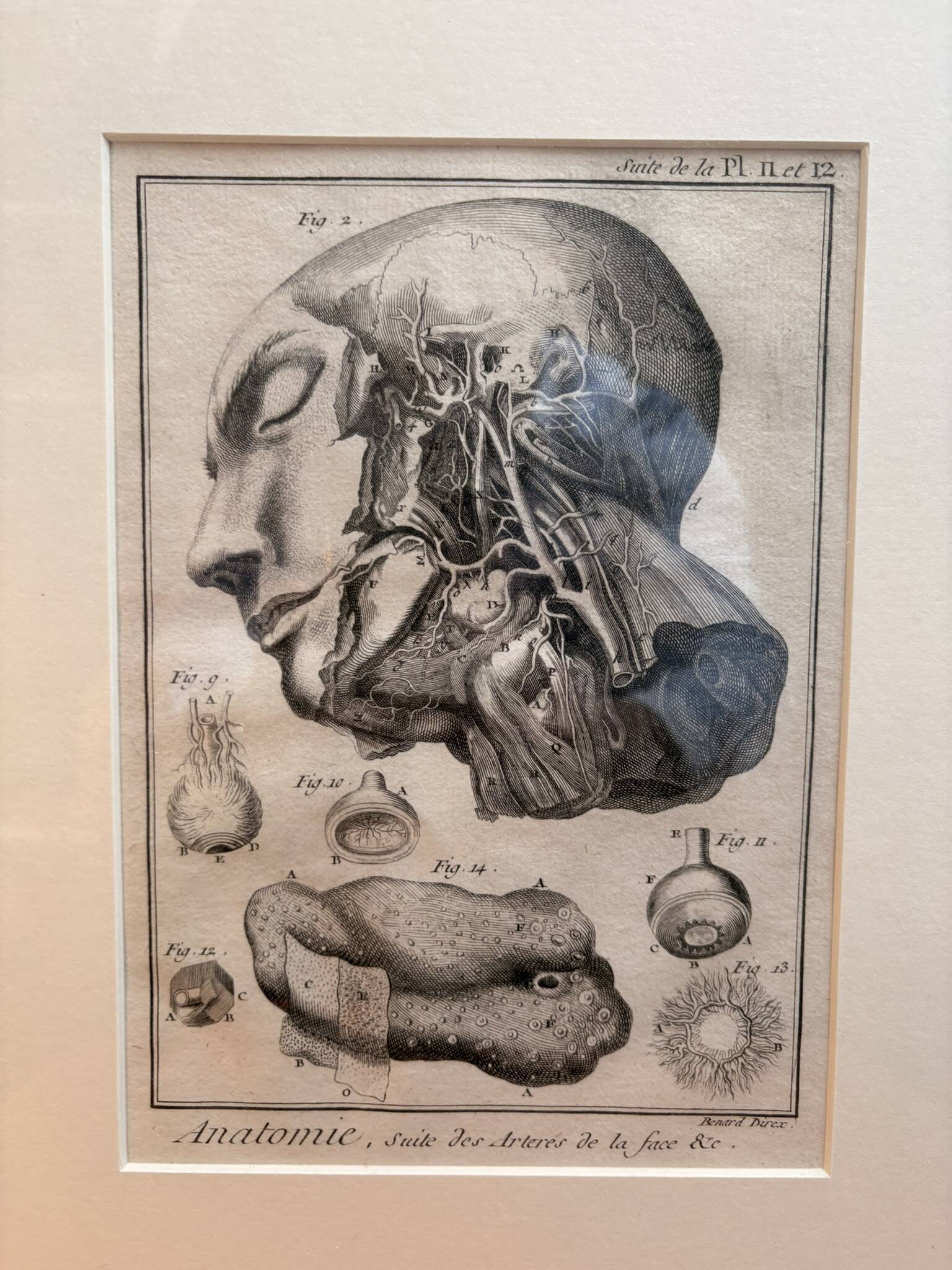 Old Print Engraving 19th Century Framed Anatomy Artery Face Bernard Dixerit