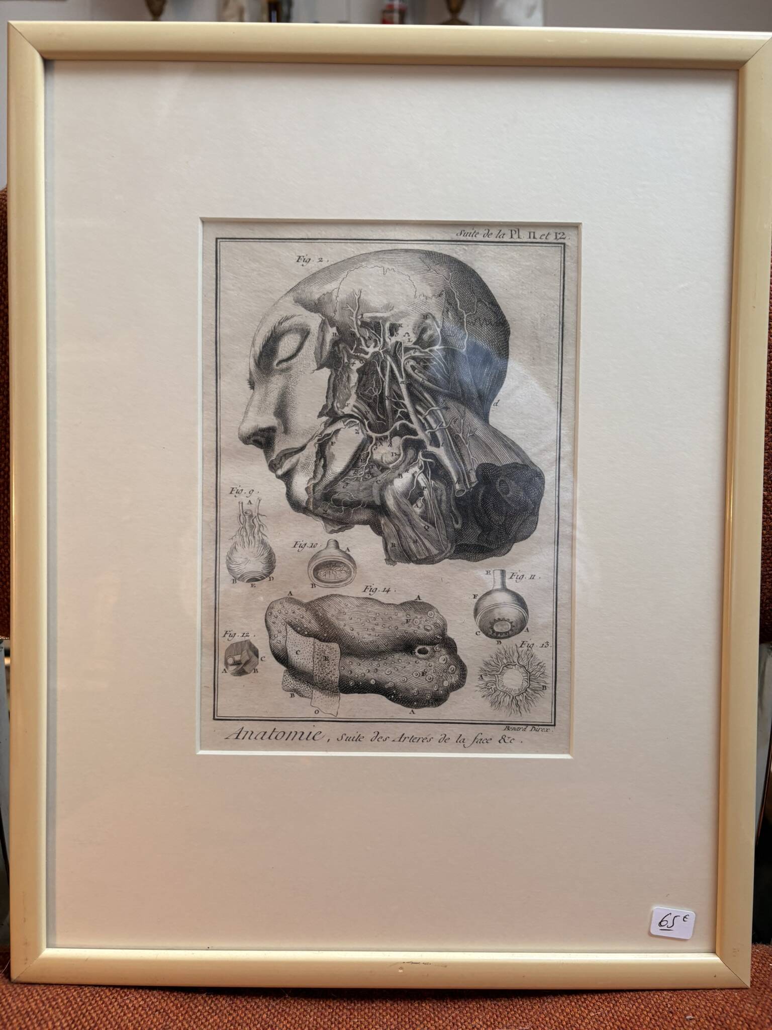 Old Print Engraving 19th Century Framed Anatomy Artery Face Bernard Dixerit