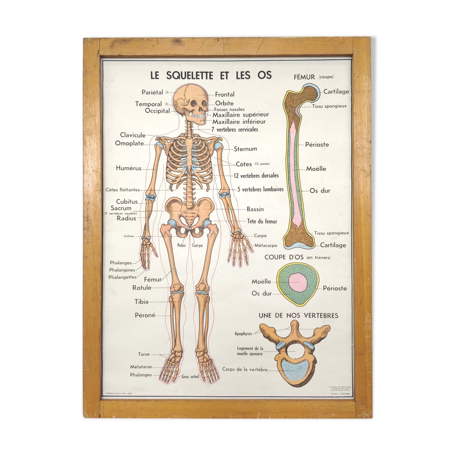 School map and wooden frame MDI Human body