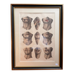 Gravure Chéiloplastique - jacob