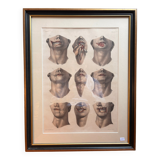 Gravure Cheiloplastic Facial Surgery Anatomy Nicolas Jacob Bourgery