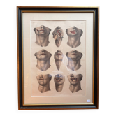 Gravure Chéiloplastique Chirurgie Faciale Anatomie Nicolas Jacob Bourgery