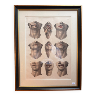 Gravure Cheiloplastic Facial Surgery Anatomy Nicolas Jacob Bourgery