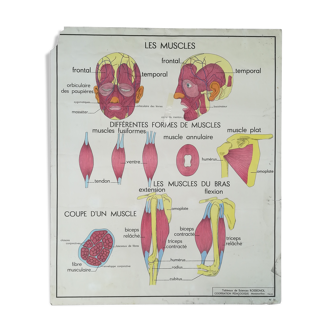 Affiche scolaire Rossignol N°13 Cyphose Scoliose N°14 Les Muscles