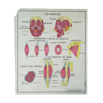 School poster Rossignol No.13 Cyphose Scoliosis No.14 Muscles