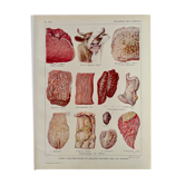 Lithograph on animal diseases from 1921