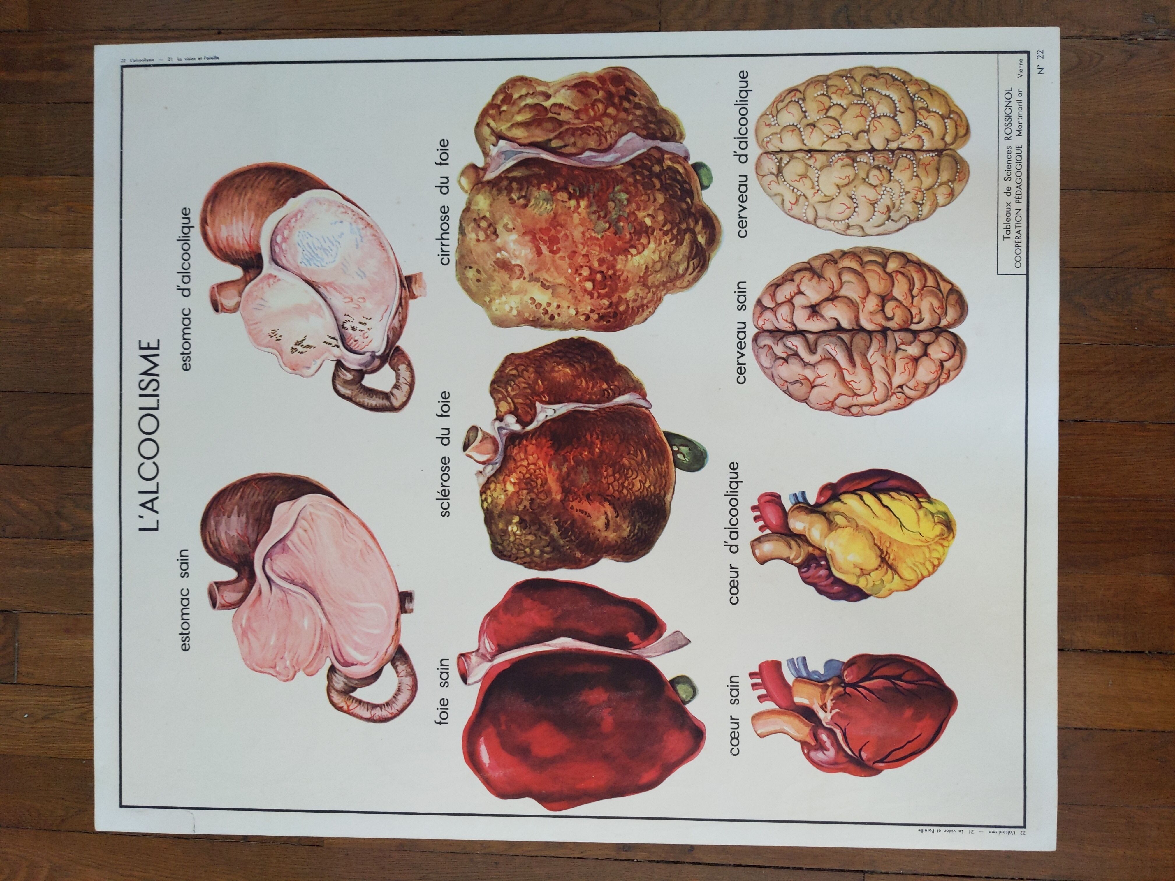 Old vintage school poster nightingale 60s liver alcoholism eye vision