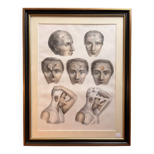 Gravure Chirurgie plastique