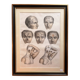 Gravure Chirurgie plastique Rhinoplastique NICOLAS Jacob Bourgery Anatomie