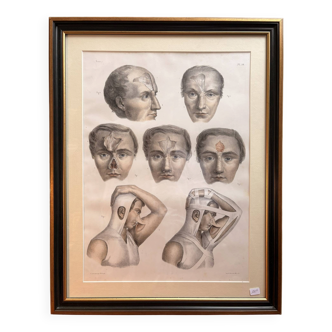 Gravure Plastic Surgery Rhinoplasty NICOLAS Jacob Bourgery Anatomy