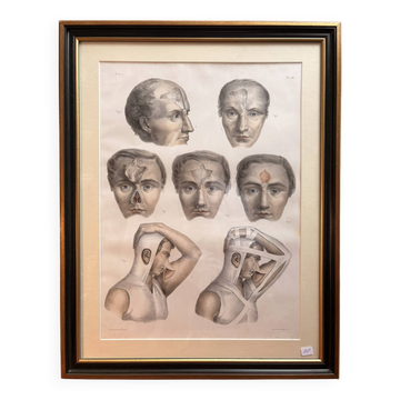 Gravure Plastic Surgery Rhinoplasty NICOLAS Jacob Bourgery Anatomy