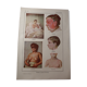 Medical board - anatomy - erysipelas