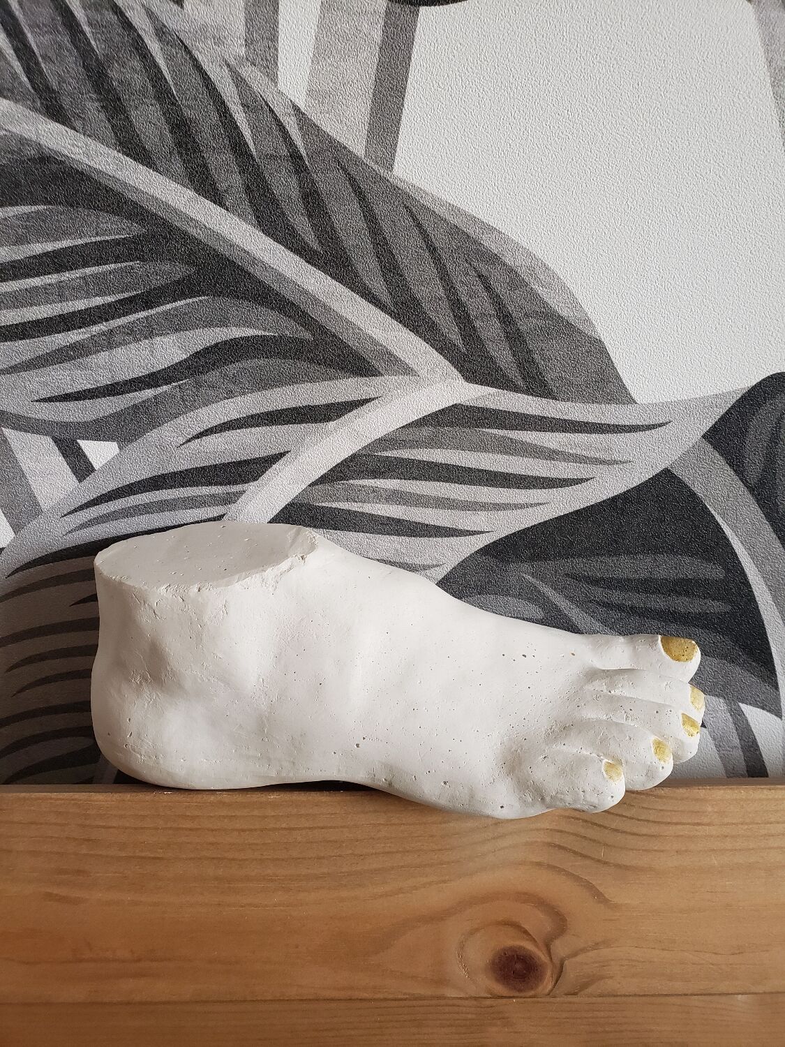 Woman's foot in plaster
