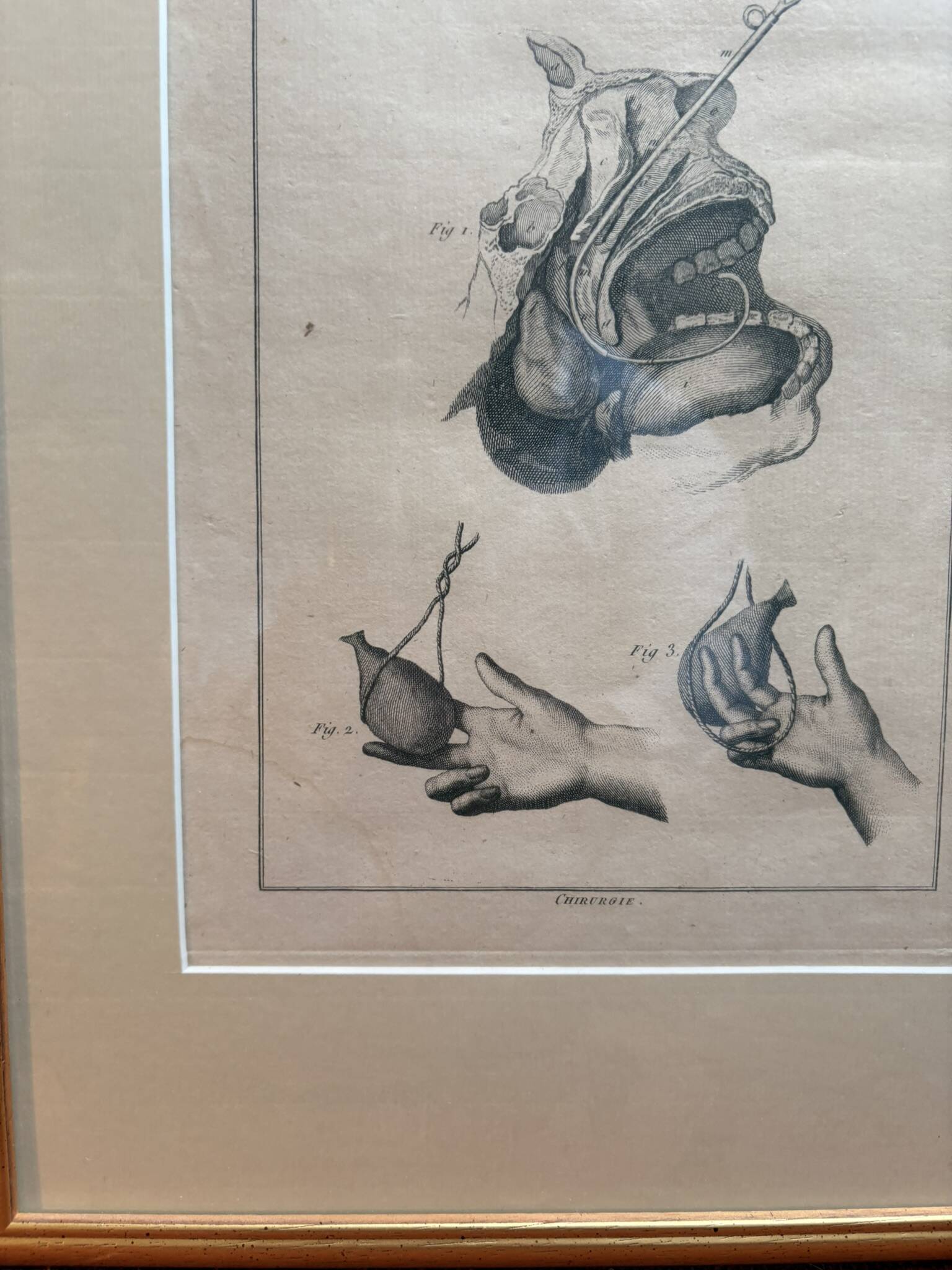 Framed Print Engraving Aphorisms Surgery Anatomy Herman Boerhaave