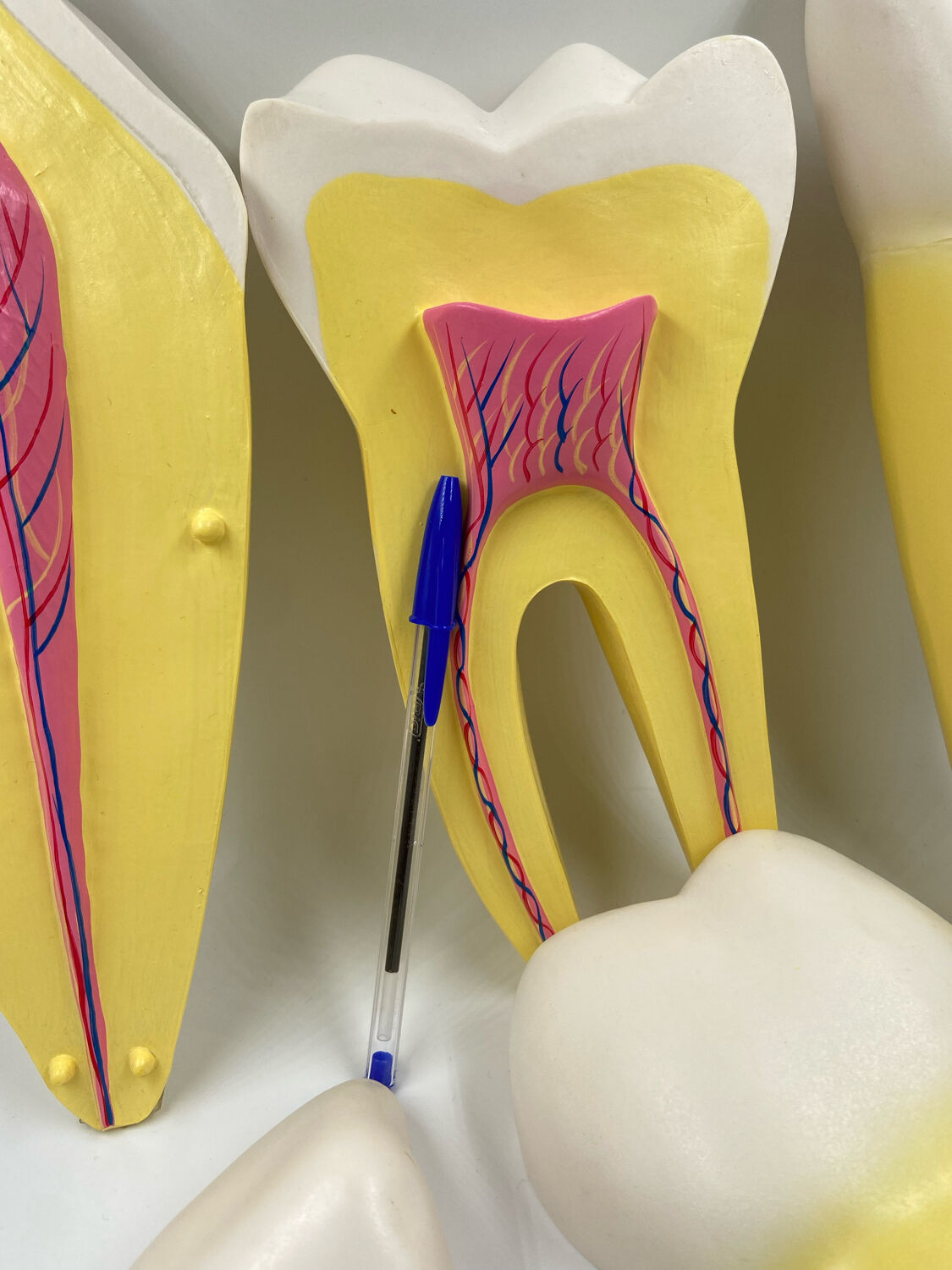 Large size dental model 3 tooth