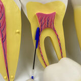 Large size dental model 3 tooth