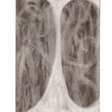 Abstract interlacing drawing in black and white 2