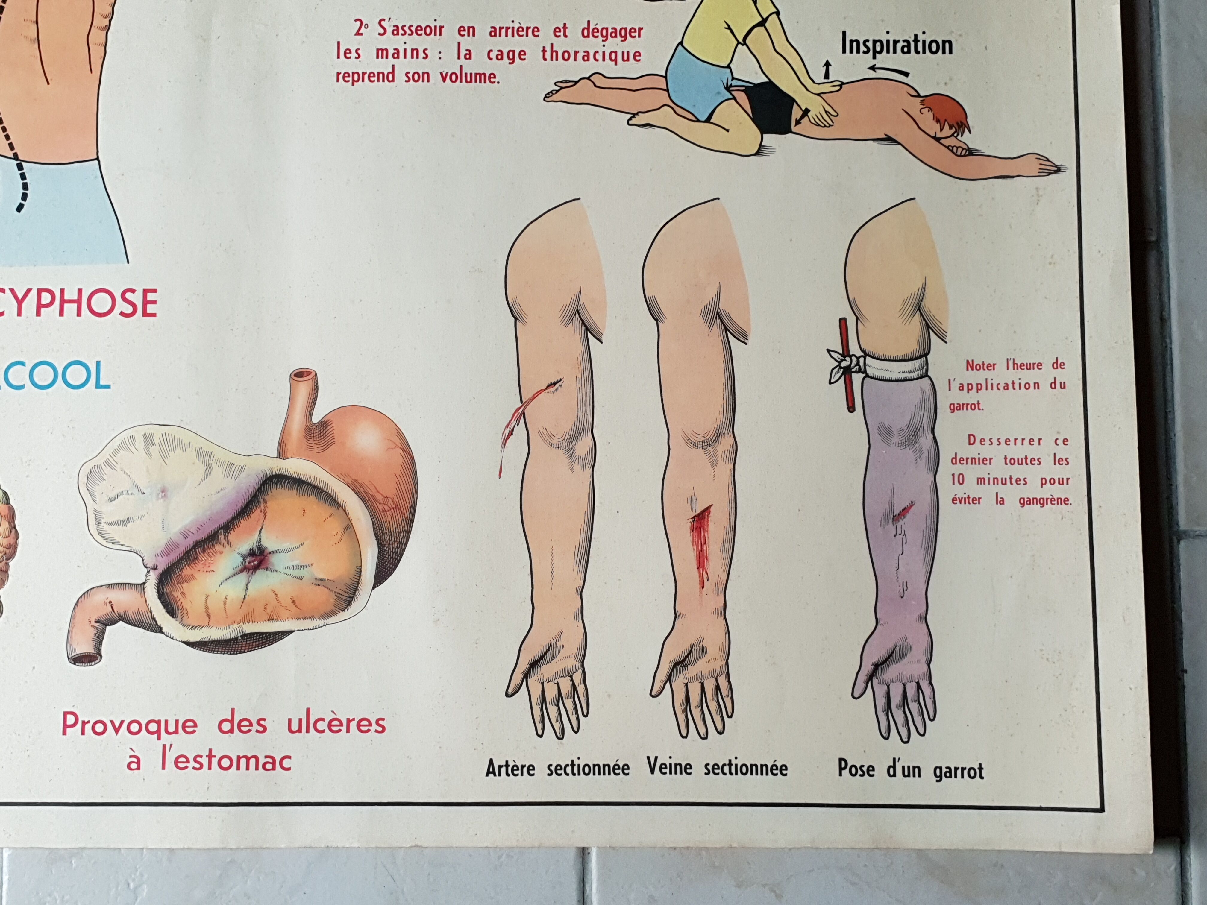 Poster school  excretion & hygiene first aid