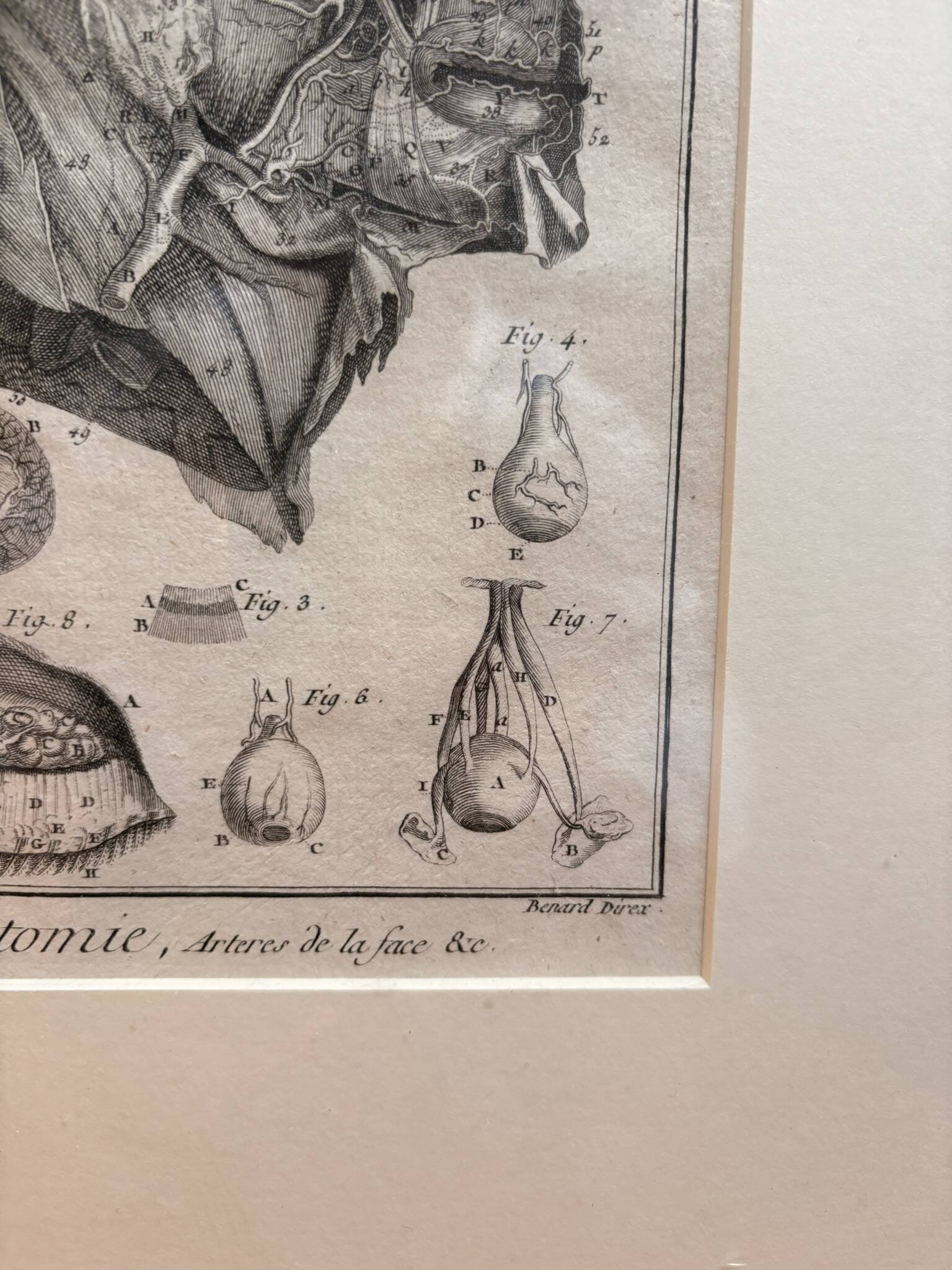 Old Print Engraving 19th Century Framed Anatomy Artery Face Bernard Dixerit