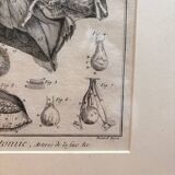 Old Print Engraving 19th Century Framed Anatomy Artery Face Bernard Dixerit