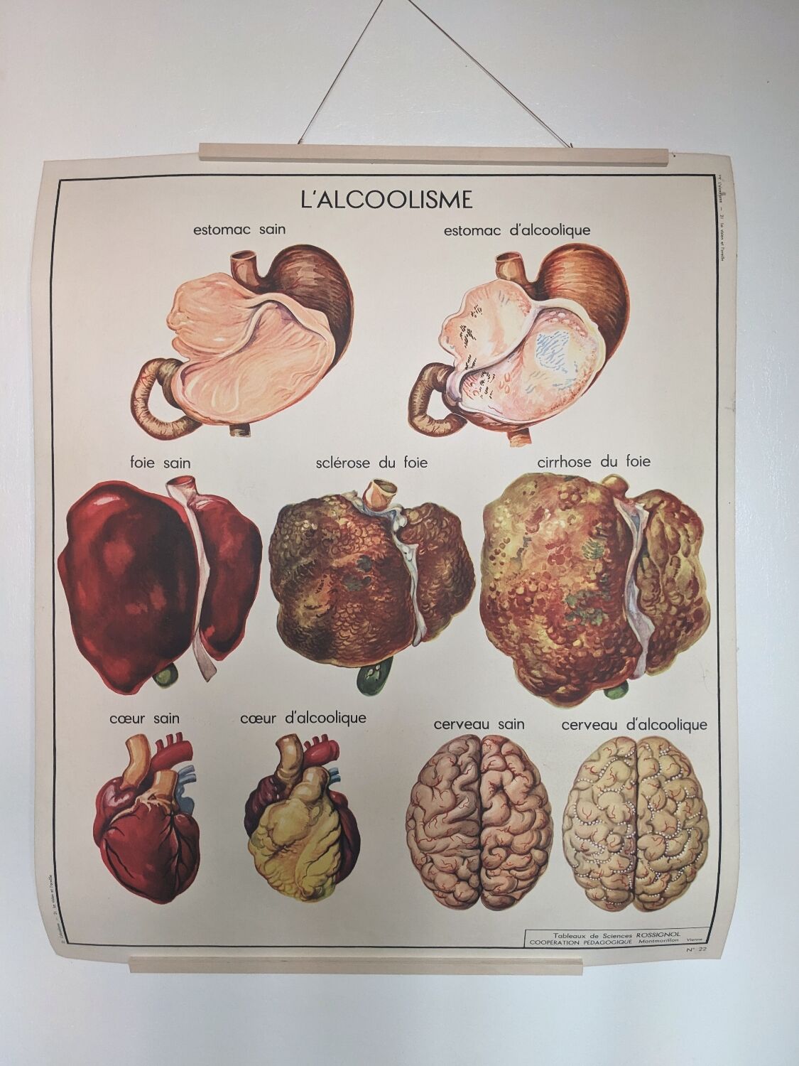 Rossignol alcoholism school poster
