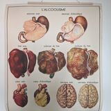 Rossignol alcoholism school poster