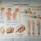Poster school  excretion & hygiene first aid