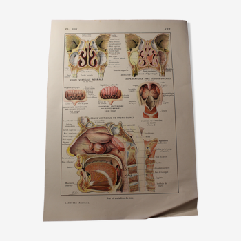 Planche médicale anatomie le nez