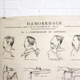 Displays educational anatomical bleeding