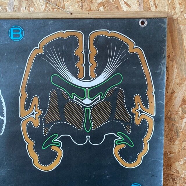 Dr. Auzoux's school poster "The brain"