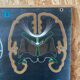 Dr. Auzoux's school poster "The brain"