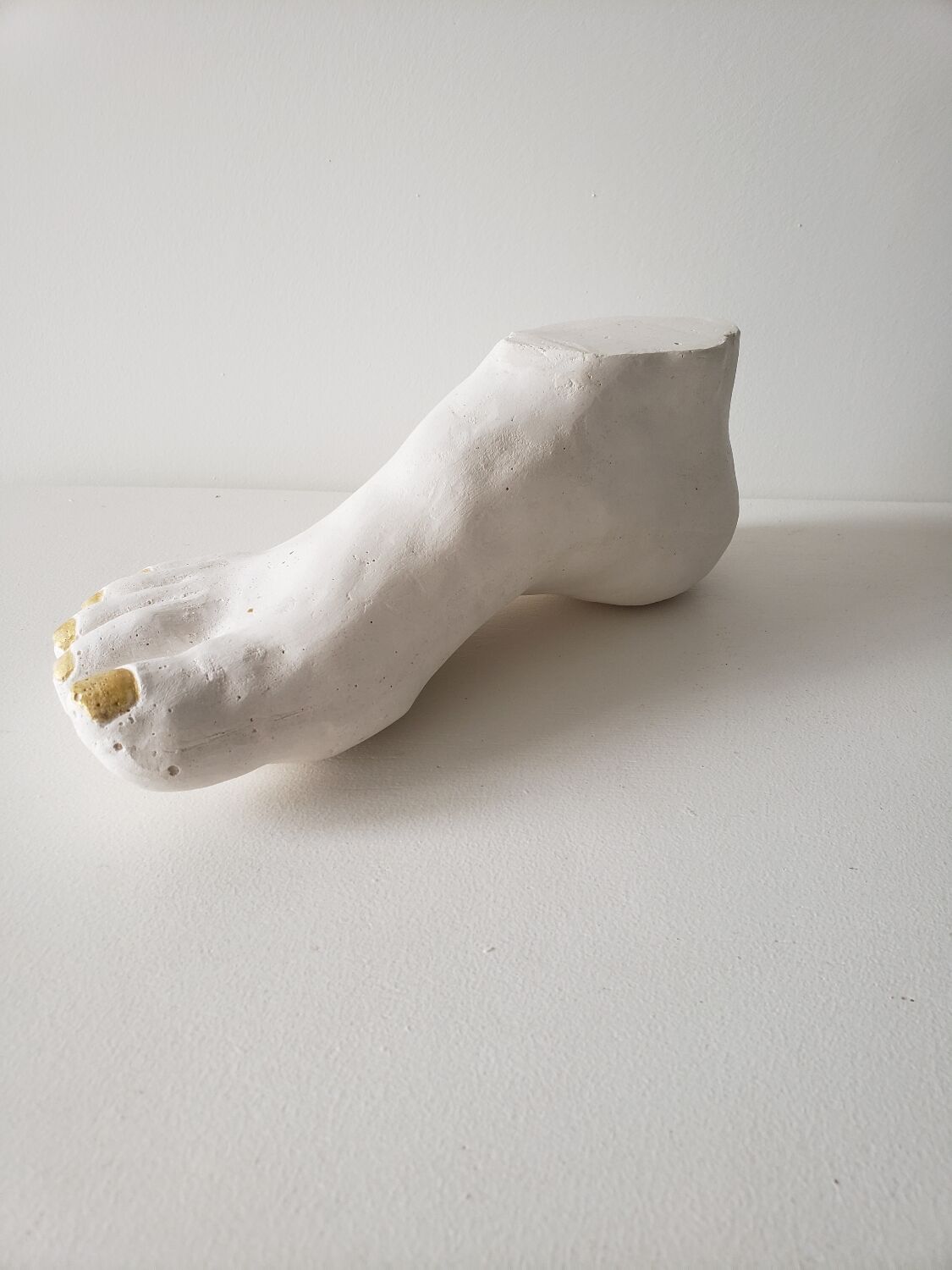 Woman's foot in plaster