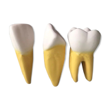Large size dental model 3 tooth