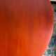 Extensible Baumann table