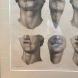 Gravure Cheiloplastic Facial Surgery Anatomy Nicolas Jacob Bourgery