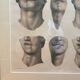 Gravure Chéiloplastique Chirurgie Faciale Anatomie Nicolas Jacob Bourgery