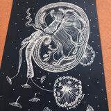 Litographie au posca sur papier noir Le rein