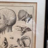 Engraving of Verney Duverney Valsava Encyclopaedia Direct Anatomy Ear