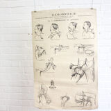 Displays educational anatomical bleeding