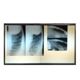 X-ray lightbox