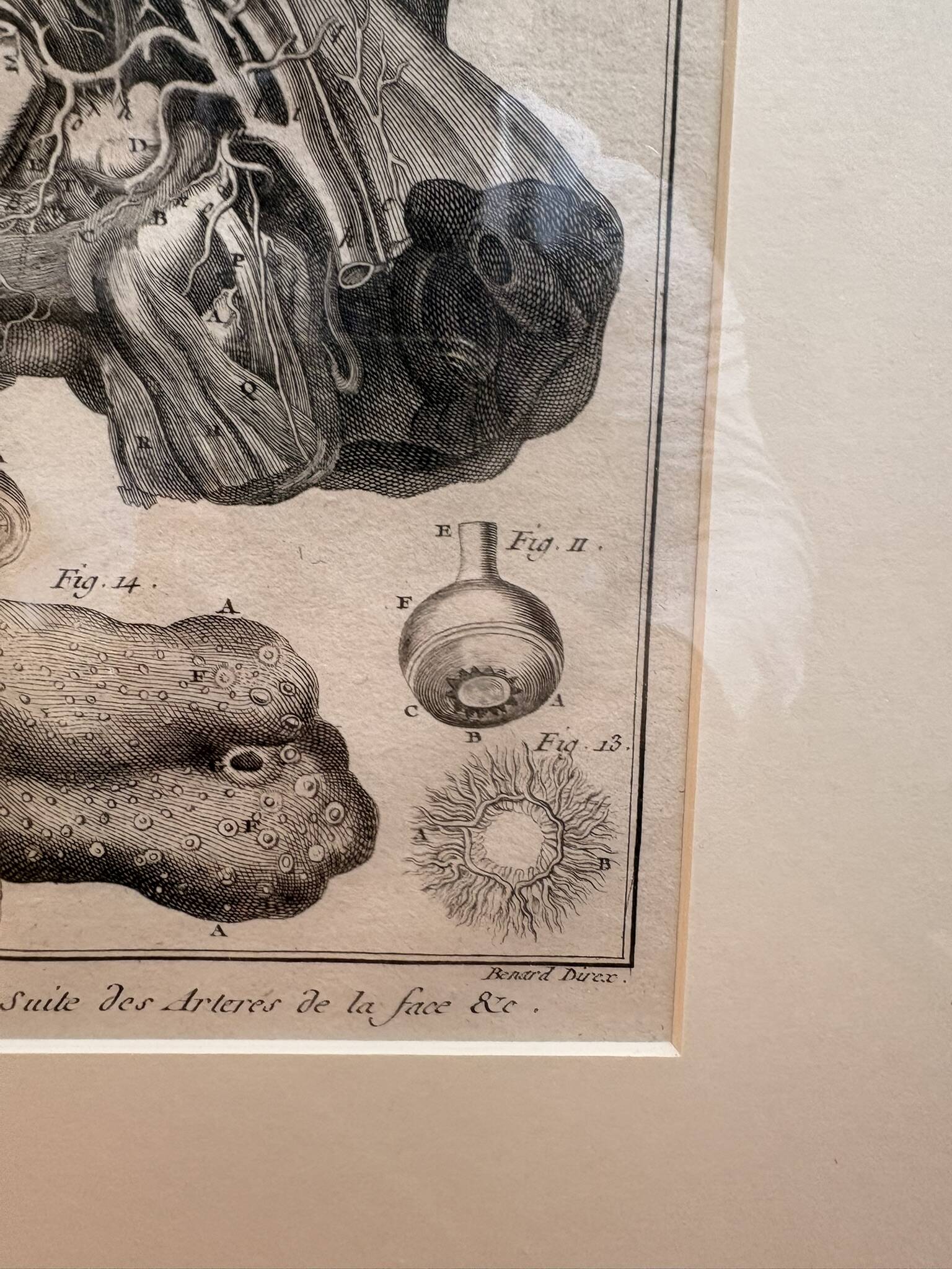 Old Print Engraving 19th Century Framed Anatomy Artery Face Bernard Dixerit