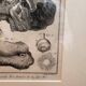 Old Print Engraving 19th Century Framed Anatomy Artery Face Bernard Dixerit