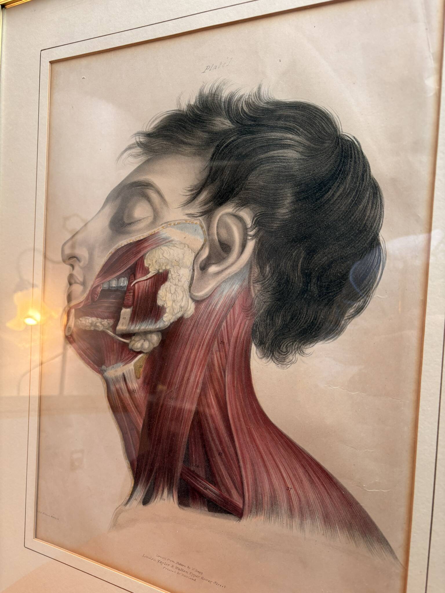 Print Engraving 19th Century The Salivary Gland Head Anatomy William Bagg